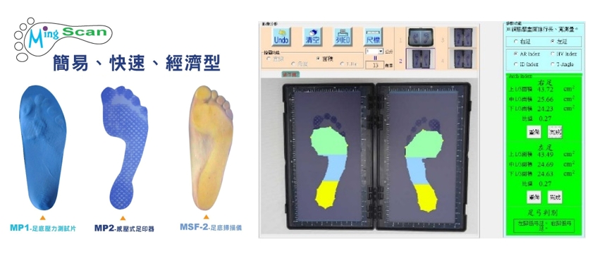 Ming Scan 足型足壓量測系統