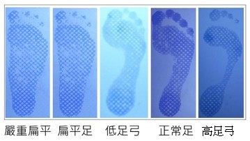 足底壓力分佈量測與步態分析圖：從足壓分布找出姿勢痠痛根源