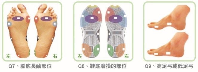 腳底長繭位置與鞋底磨損區域自我檢測示意圖
