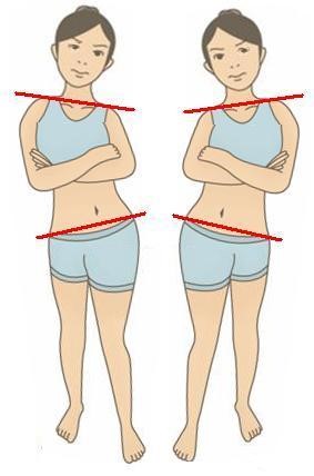 下肢閉鎖鏈示意圖:足弓塌陷導致小腿、大腿內旋與骨盆歪斜